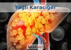 Karaciğer Yağlanması: Sebepleri, Belirtileri ve Önleme Yolları