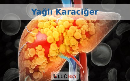 Karaciğer Yağlanması: Sebepleri, Belirtileri ve Önleme Yolları