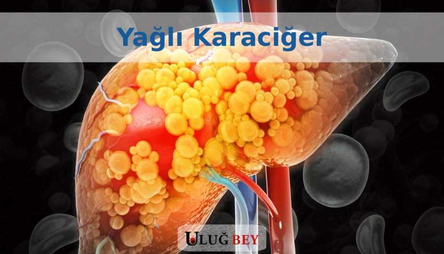 Karaciğer Yağlanması: Sebepleri, Belirtileri ve Önleme Yolları
